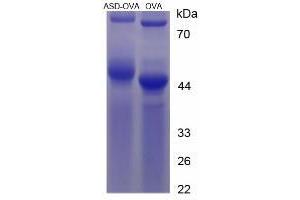 Image no. 2 for Androstenedione (ASD) protein (Ovalbumin) (ABIN1880303) (Androstenedione Protein (ASD) (Ovalbumin))
