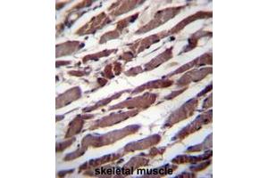 PUS1 Antibody (C-term) immunohistochemistry analysis in formalin fixed and paraffin embedded human skeletal muscle followed by peroxidase conjugation of the secondary antibody and DAB staining.