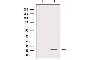Western blot analysis of extracts from Mouse Spleen, using Histone H3K79me2 Antibody. (Histone 3 anticorps  (H3K79me2))
