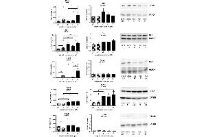 mRNA expression (all n = 6) of HRas, MAPK14 (p38), CCL2, DOK1 and PTK2B related to GAPDH mRNA expression, protein expression of HRas (n = 6), p38 (n = 6), CCL2 (n = 4), DOK1 (n = 7-8) and PTK2B (n = 3) related to GAPDH expression in A549 () and A549rCDDP2000 () before (ctrl) and after treatment with 11 μM cisplatin (11) or 34 μM cisplatin (34) presented as mean ± SEM, as well as representative Western blots. (DOK1 anticorps)