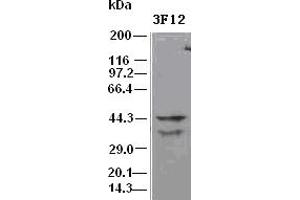 DFF45 antibody (3F12) at 1:500 dilution + Hela cell lysate