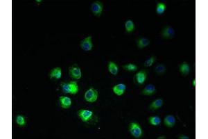Immunofluorescent analysis of A2780 cells using ABIN7165108 at dilution of 1:100 and Alexa Fluor 488-congugated AffiniPure Goat Anti-Rabbit IgG(H+L) (ARV1 anticorps  (AA 1-143))