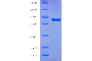 SDS-PAGE (SDS) image for Suppressor of Cytokine Signaling 3 (SOCS3) (AA 1-225), (full length) protein (His-SUMO Tag) (ABIN5710398)