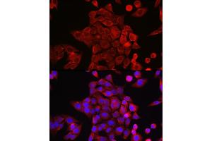 Immunofluorescence analysis of HeLa cells using ST Rabbit pAb (ABIN6128541, ABIN6148581, ABIN6148582 and ABIN6213980) at dilution of 1:200 (40x lens).