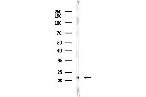 anti-serine/arginine-Rich Splicing Factor 3 (SRSF3) (C-Term) antibody