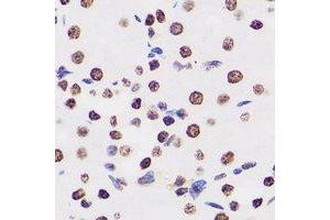 Immunohistochemical analysis of BAF155 staining in human kidney formalin fixed paraffin embedded tissue section.
