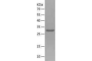 Western Blotting (WB) image for Tensin 3 (TNS3) (AA 366-571) protein (His tag) (ABIN7125336)