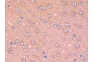 IHC-P analysis of Rat Cerebrum Tissue, with DAB staining. (Renin anticorps  (AA 144-237))