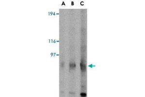 Western blot analysis of GRIK4 in rat brain tissue lysate with GRIK4 polyclonal antibody  at (A) 0.