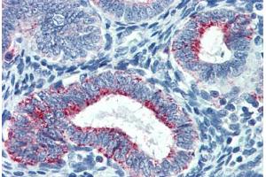 Human Uterus: Formalin-Fixed, Paraffin-Embedded (FFPE) (TYMS anticorps  (AA 111-211))
