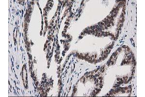 Image no. 1 for anti-Protein Kinase C, epsilon (PRKCE) antibody (ABIN1500230) (PKC epsilon anticorps)