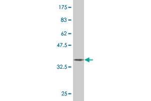 Western Blot detection against Immunogen (37. (ERF anticorps  (AA 181-290))