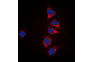 Immunofluorescent analysis of DUSP6 staining in HepG2 cells.