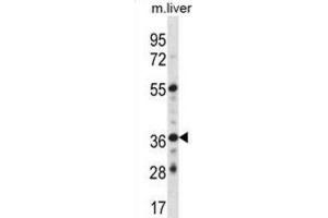Western Blotting (WB) image for anti-G Protein-Coupled Estrogen Receptor 1 (GPER) antibody (ABIN2998385) (GPER anticorps)
