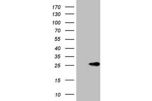 Western Blotting (WB) image for anti-ATP-Binding Cassette, Sub-Family C (CFTR/MRP), Member 5 (ABCC5) antibody (ABIN2715617) (ABCC5 anticorps)