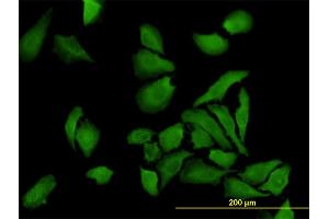 Immunofluorescence of monoclonal antibody to BUB1B on HeLa cell.