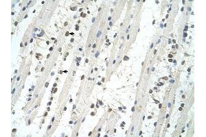 TRIM32 antibody was used for immunohistochemistry at a concentration of 4-8 ug/ml to stain Skeletal muscle cells (arrows) in Human Muscle. (TRIM32 anticorps  (C-Term))
