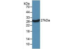 Detection of Recombinant KPNa2, Human using Monoclonal Antibody to Karyopherin Alpha 2 (KPNa2) (KPNA2 anticorps  (AA 157-412))