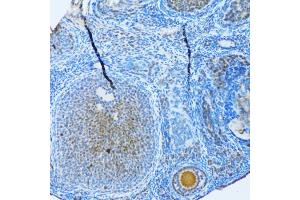 Immunohistochemistry of paraffin-embedded rat ovary using MAP1LC3B antibody (ABIN5973262) at dilution of 1/100 (20x lens). (LC3B anticorps)