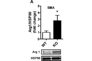 Elevated arginase1 expression and increased arginase inhibitor-induced relaxation of Cavin-1-/- arteries.