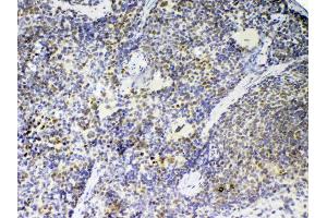 IHC analysis of PTPN22 using anti-PTPN22 antibody .