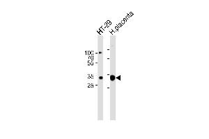 Western blot analysis of lysates from HT-29 cell line and human placenta tissue lysate(from left to right),using GJB7 Antibody (ABIN6241921). (GJB7 anticorps)