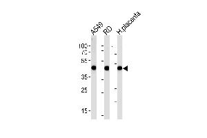 Western blot analysis in A549,RD cell line and human placenta lysates (35ug/lane). (Actin anticorps  (C-Term))