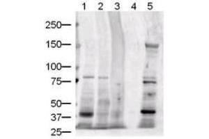 Image no. 3 for anti-Jagged 1 (JAG1) (AA 110-125) antibody (ABIN401024) (JAG1 anticorps  (AA 110-125))