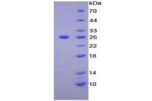 SDS-PAGE of Protein Standard from the Kit (Highly purified E. (MMP11 Kit ELISA)