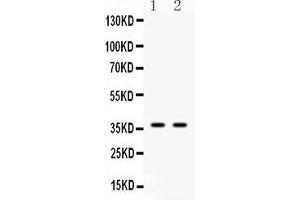 Western blot analysis of Annexin VIII using anti-Annexin VIII antibody . (Annexin VIII anticorps  (N-Term))