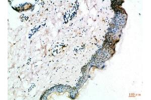 Immunohistochemical analysis of paraffin-embedded Human-skin, antibody was diluted at 1:100