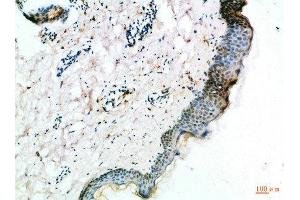 Immunohistochemical analysis of paraffin-embedded Human-skin, antibody was diluted at 1:100 (FZD4 anticorps  (AA 11-60))