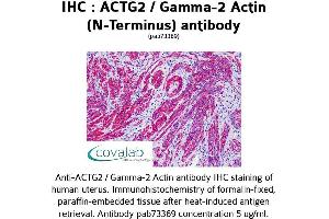 Image no. 1 for anti-Actin, gamma 2, Smooth Muscle, Enteric (ACTG2) antibody (ABIN1731474) (ACTG2 anticorps)