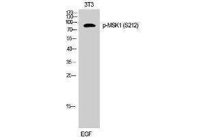 Western Blotting (WB) image for anti-Ribosomal Protein S6 Kinase, 90kDa, Polypeptide 5 (RPS6KA5) (pSer212) antibody (ABIN3179703) (MSK1 anticorps  (pSer212))