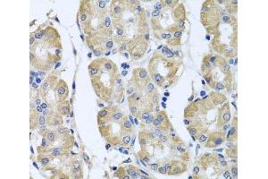 Immunohistochemistry of paraffin-embedded Human stomach using BAG5 Polyclonal Antibody at dilution of 1:100 (40x lens).