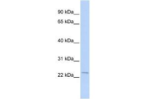 WB Suggested Anti-STK32A Antibody Titration: 0. (STK32A anticorps  (N-Term))