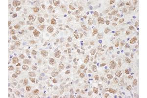 Immunohistochemistry (IHC) image for anti-Chromosome 7 Open Reading Frame 27 (C7orf27) (C-Term) antibody (ABIN7448427)