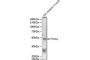 Western blot analysis of extracts of Rat skeletal muscle, using P4H antibody (0538) at 1:500 dilution. (P4HA1 anticorps  (AA 235-534))
