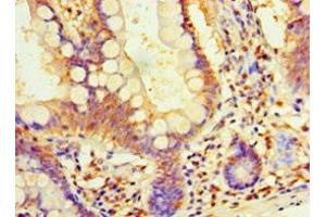 Immunohistochemistry of paraffin-embedded human small intestine tissue using ABIN7164411 at dilution of 1:100 (DIMT1 anticorps  (AA 1-313))