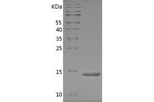 Western Blotting (WB) image for Tumor Necrosis Factor alpha (TNF alpha) (AA 77-233) protein (His tag) (ABIN7125534)
