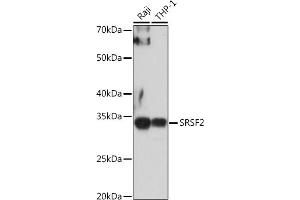 Western blot analysis of extracts of various cell lines, using SRSF2 antibody (ABIN1682677, ABIN3017915, ABIN3017916, ABIN5664377 and ABIN6220303) at 1:1000 dilution. (SRSF2 anticorps  (AA 1-75))