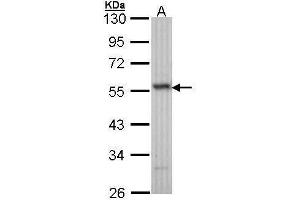 WB Image Sample (30 ug of whole cell lysate) A: H1299 10% SDS PAGE antibody diluted at 1:1000 (ERG anticorps  (C-Term))