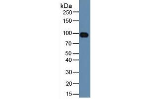 Rabbit Detection antibody from the kit in WB with Positive Control: Human serum. (HIF1A Kit CLIA)
