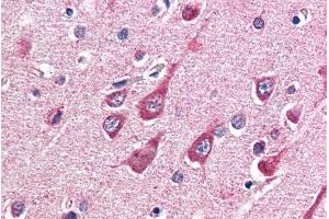 ABIN190863 (5µg/ml) staining of paraffin embedded Human Cortex. (OGT anticorps  (Internal Region))