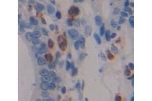 IHC-P analysis of Human Tissue, with DAB staining. (DUSP5 anticorps  (AA 1-135))