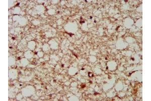 IHC image of ABIN7157906 diluted at 1:300 and staining in paraffin-embedded human brain tissue performed on a Leica BondTM system.