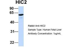 Host:  Rabbit  Target Name:  HIC2  Sample Type:  Human Fetal Liver  Antibody Dilution:  1. (HIC2 anticorps  (Middle Region))
