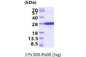 SDS-PAGE (SDS) image for Cellular Repressor of E1A-Stimulated Genes 1 (CREG1) (AA 32-220) protein (His tag) (ABIN5854797)