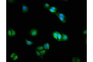 Immunofluorescence staining of HepG2 cells with ABIN7150786 at 1:200, counter-stained with DAPI.
