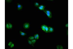 Immunofluorescence staining of HepG2 cells with ABIN7150786 at 1:200, counter-stained with DAPI. (DUSP9 anticorps  (AA 142-263))